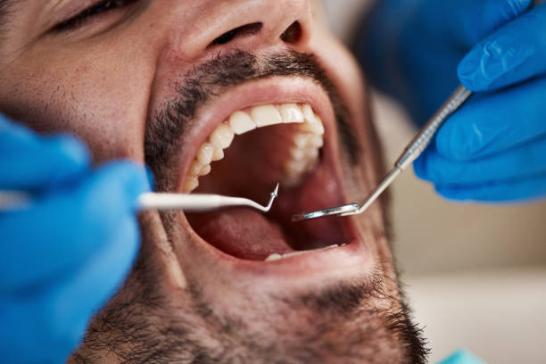Best Cosmetic Emergency Dentistry in Deridder, LA