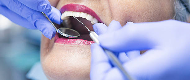 Best Same-Day Emergency Dental Services in Deridder, LA